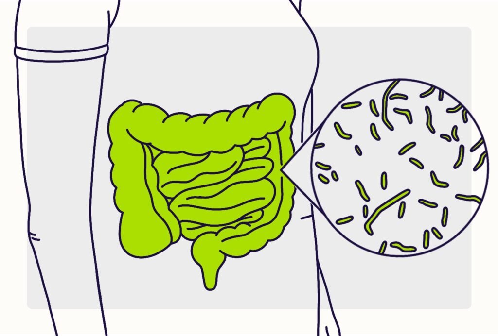 Can’t Stop Diarrhea? Try These Effective Remedies!
