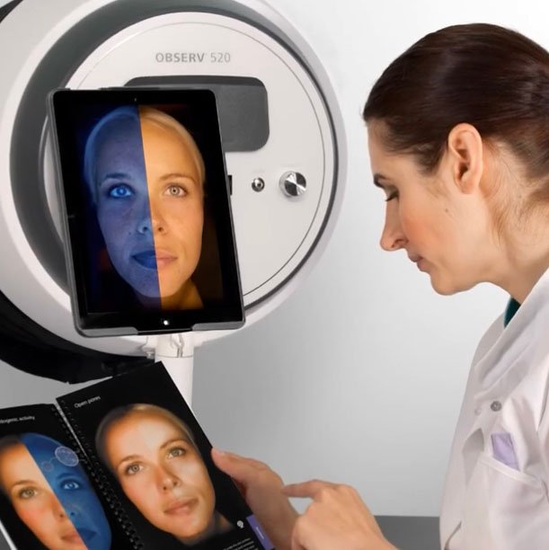 SG Facial Equipment Price