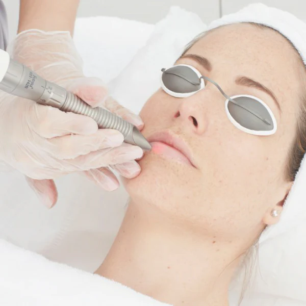 White Doll Treatment