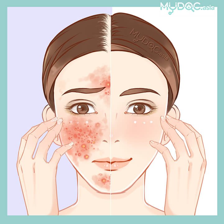 Discover the Top 5 Skincare Clinics in Malaysia: Your Path to Radiant Skin