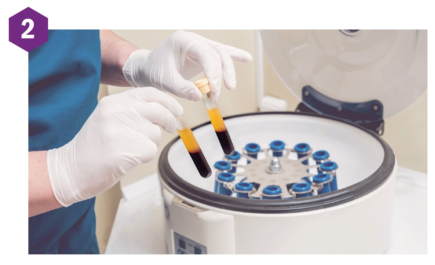 Platelet-riched plasma