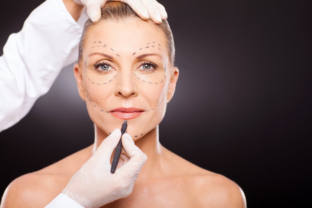 Full-Face Fat Grafting