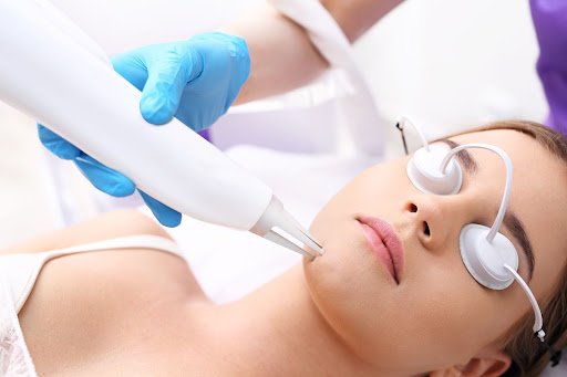 laser spot removal