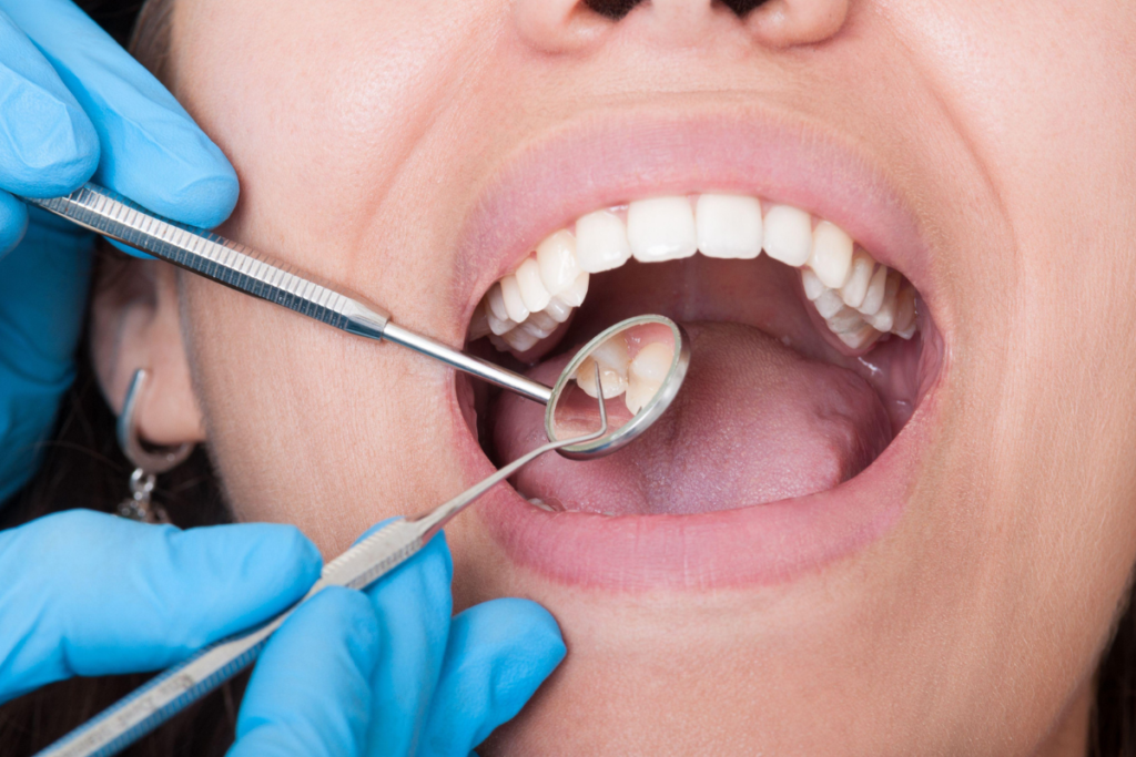 Five Essential Standards for Choosing a Dental Clinic Yishun: What You Need to Know Before Your First Appointment
